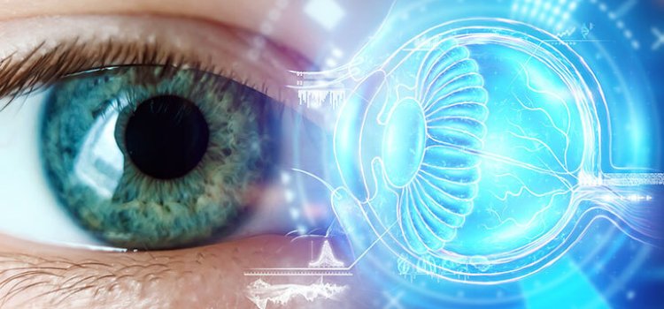 Katarakt Nedir?
