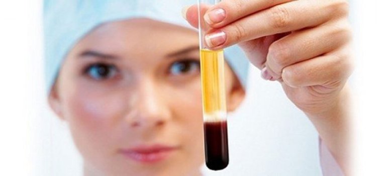 PRP Tedavisi Nedir?