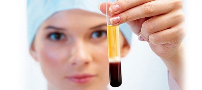 PRP Tedavisi Nedir?