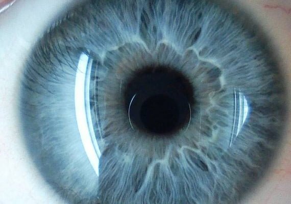 Retina Ameliyatları (Vitrektomi)